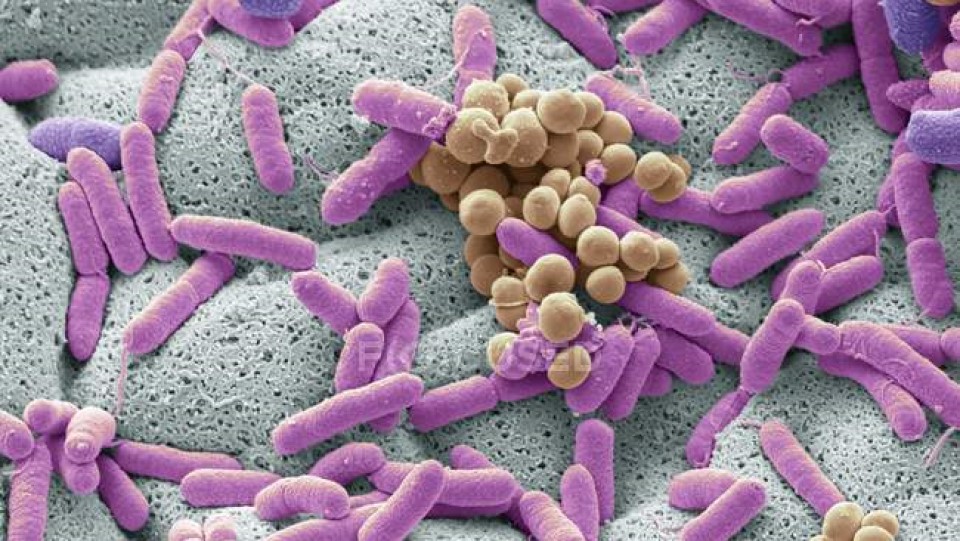 Бактерии - возбудители листериоза